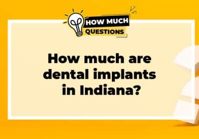 How much are dental implants in Indiana?