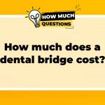 How much does a dental bridge cost?